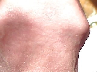 Foreskin In Sunlight - 5 Minute Video