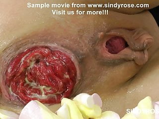 Anal Prolapse, Anal Hole, Extreme Insertions