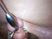 Peehole stretching using a #13 Rosebud